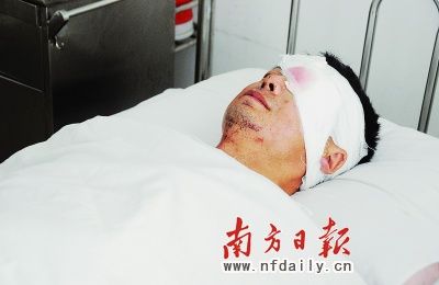手机电池床头充电炸伤男子左眼