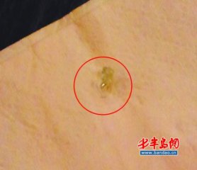 ������ζǧ����Գ��������챻����